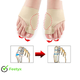 Feetyx™ | Correcteur orthopédique pour Hallux valgus